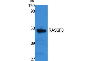 Western Blotting (WB) image for anti-Ras Association (RalGDS/AF-6) Domain Family (N-terminal) Member 8 (RASSF8) (Internal Region) antibody (ABIN3178131) (RASSF8 anticorps  (Internal Region))