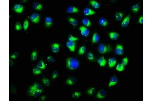 Immunofluorescence staining of Hela cells with ABIN7146972 at 1:333, counter-stained with DAPI. (CTNNA1 anticorps  (AA 1-288))