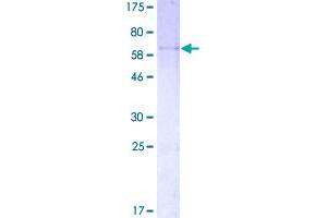 Image no. 1 for Protein Phosphatase 1, Regulatory Subunit 3C (PPP1R3C) (AA 1-317) protein (GST tag) (ABIN1315993)