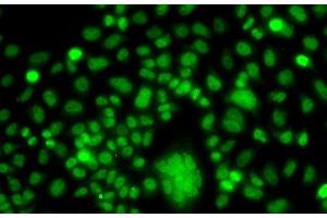 Immunofluorescence analysis of A549 cells using PPAN Polyclonal Antibody (PPAN anticorps)
