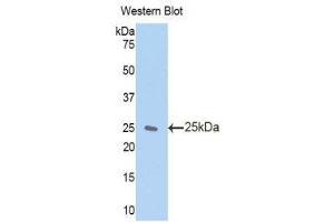 Western Blotting (WB) image for anti-Zinc Finger, AN1-Type Domain 6 (ZFAND6) (AA 19-208) antibody (ABIN1860972)