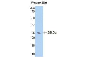 Western Blotting (WB) image for anti-Zinc Finger, AN1-Type Domain 6 (ZFAND6) (AA 19-208) antibody (ABIN1860972) (ZFAND6 anticorps  (AA 19-208))