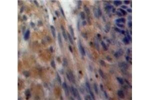 Used in DAB staining on fromalin fixed paraffin-embedded Ovary tissue (Inhibin alpha anticorps  (AA 233-366))