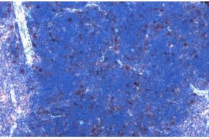 CDK6 antibody [N1C3] detects CDK6 protein at nucleus by immunohistochemical analysis.