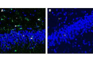 Expression of CD9 in rat hippocampus. (CD9 anticorps  (Extracellular))
