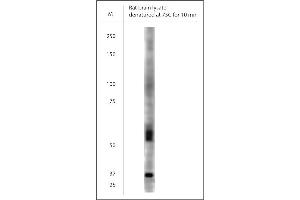 WB on rat brain lysate using Rabbit antibody to VGluT1  at 1:300 dilution. (SLC17A7 anticorps)