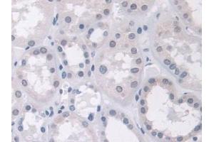 Detection of AHNAK in Human Kidney Tissue using Polyclonal Antibody to Desmoyokin (AHNAK)