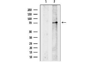 anti-Phenylalanine Hydroxylase (N-Term) antibody