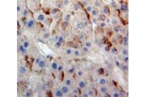 Used in DAB staining on fromalin fixed paraffin-embedded Liver tissue (ABCB11 anticorps  (AA 420-656))