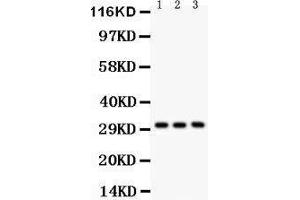 Anti-VDAC Picoband antibody, Western blotting All lanes: Anti VDAC  at 0.
