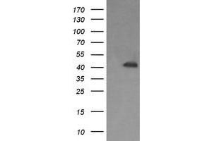 Image no. 1 for anti-Parvin, alpha (PARVA) antibody (ABIN1496447) (Parvin alpha anticorps)