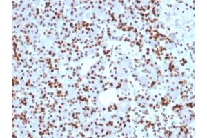 Formalin-fixed, paraffin-embedded human Pancreas stained with SOX9 Mouse Monoclonal Antibody (SOX9/2398). (SOX9 anticorps  (AA 393-508))