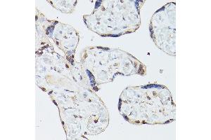 Immunohistochemistry of paraffin-embedded human placenta using ADK Rabbit pAb  at dilution of 1:350 (40x lens).