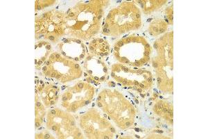 Immunohistochemistry of paraffin-embedded human kidney using CALCOCO1 antibody at dilution of 1:100 (40x lens). (CALCOCO1 anticorps)