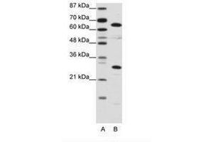 Image no. 1 for anti-High Mobility Group Box 4 (HMGB4) (C-Term) antibody (ABIN6736129) (HMGB4 anticorps  (C-Term))