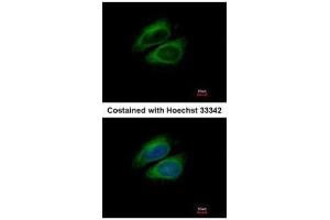 ICC/IF Image Immunofluorescence analysis of methanol-fixed HeLa, using CSDE1, antibody at 1:200 dilution.