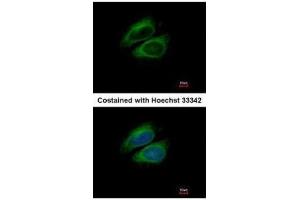 ICC/IF Image Immunofluorescence analysis of methanol-fixed HeLa, using CSDE1, antibody at 1:200 dilution. (CDSE1 anticorps  (Internal Region))