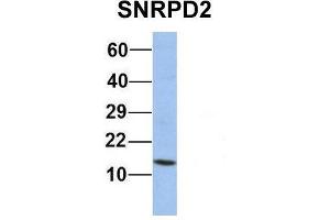 Host:  Rabbit  Target Name:  SNRPD2  Sample Type:  Human Jurkat  Antibody Dilution:  1. (SNRPD2 anticorps  (Middle Region))
