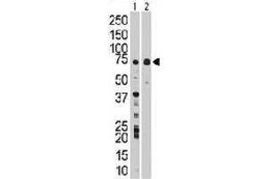 The WEE1 polyclonal antibody  is used in Western blot to detect WEE1 in Jurkat cell lysate (Lane 1) and mouse liver tissue lysate (Lane 2) . (WEE1 anticorps  (Internal Region))