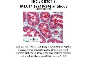 Image no. 1 for anti-CREB Regulated Transcription Coactivator 1 (CRTC1) (AA 19-34) antibody (ABIN1733326) (CRTC1 anticorps  (AA 19-34))