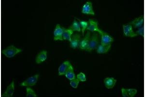Immunofluorescence staining of Hela cells with ABIN7127637 at 1:23, counter-stained with DAPI. (Recombinant NDRG1 anticorps)