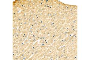 Immunohistochemistry of paraffin embedded rat heart using ATP2A2 (ABIN7075545) at dilution of 1: 500 (400x lens) (SERCA2 ATPase anticorps)