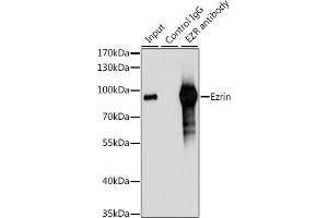 Immunoprecipitation analysis of 200 μg extracts of 293T cells, using 3 μg Ezrinin antibody (ABIN6129377, ABIN6140400, ABIN6140401 and ABIN6213959).