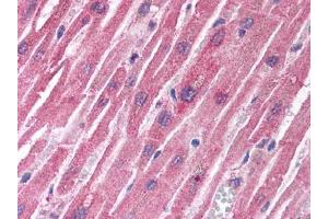 Image no. 1 for anti-Tuberous Sclerosis 1 (TSC1) antibody (ABIN302894) (TSC1 anticorps)