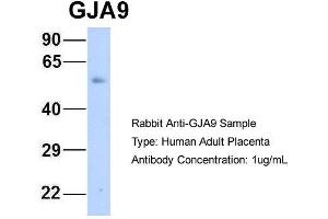 Host: Rabbit Target Name: GJA9 Sample Type: Human Adult Placenta Antibody Dilution: 1. (GJA9 anticorps  (Middle Region))
