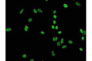 Immunofluorescence staining of Hela cells(treated by 15 mM sodium butyrate for 30 min) with ABIN7127271 at 1:65,counter-stained with DAPI. (Recombinant HIST1H4A anticorps  (acLys56))