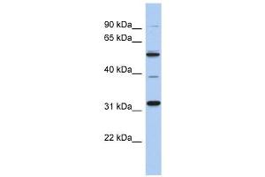 MGC51025 antibody used at 1 ug/ml to detect target protein. (TBC1D26 anticorps  (Middle Region))