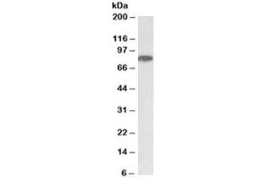 Western blot testing of HeLa nuclear lysate with CHUK antibody at 1ug/ml. (IKK alpha anticorps)