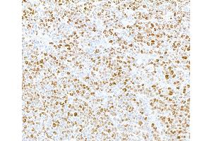 Immunohistochemistry (IHC) image for anti-Minichromosome Maintenance Complex Component 2 (MCM2) (pSer108) antibody (ABIN7449366)