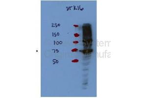 STK16 antibody - middle region  validated by WB using Hek 293T Cells at 1:1000. (STK16 anticorps  (Middle Region))