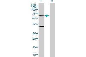 Western Blot analysis of GLRA1 expression in transfected 293T cell line by GLRA1 MaxPab polyclonal antibody. (GLRA1 anticorps  (AA 1-449))