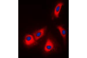 Immunofluorescent analysis of Adenosine Kinase staining in HepG2 cells.