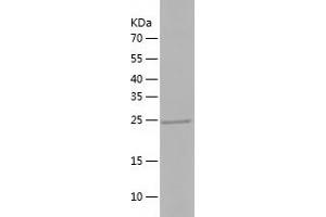Western Blotting (WB) image for Phosphatase, Orphan 2 (PHOSPHO2) (AA 1-241) protein (His-IF2DI Tag) (ABIN7124395)