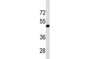 TGFBR1 antibody western blot analysis in human HL-60 lysate. (TGFBR1 anticorps  (AA 145-172))