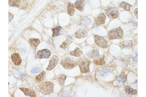 Immunohistochemistry (IHC) image for anti-Histone Deacetylase 7 (HDAC7) (AA 902-952) antibody (ABIN7448594) (HDAC7 anticorps  (AA 902-952))