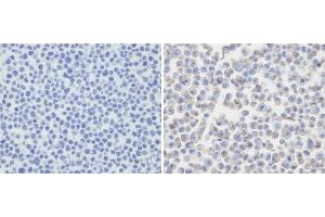 Immunohistochemical analysis of PDL-2 in untransfected(left) or transfected(right) with 293T cell sections. (PDCD1LG2 anticorps  (N-Term))
