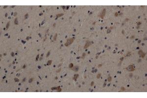 Immunohistochemistry of paraffin-embedded Rat brain using Cleaved-NOTCH1 (V1754) Polyclonal Antibody at dilution of 1:200 (Notch1 anticorps  (Cleaved-Val1754))