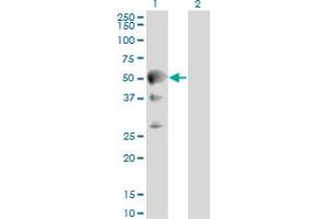 Western Blot analysis of SEPT10 expression in transfected 293T cell line by SEPT10 monoclonal antibody (M01), clone 2A12. (Septin 10 anticorps  (AA 1-454))