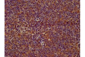 IHC image of ABIN7169333 diluted at 1:200 and staining in paraffin-embedded human lymph node tissue performed on a Leica BondTM system.