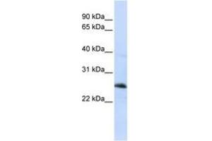 Image no. 1 for anti-Reticulon 1 (RTN1) (C-Term) antibody (ABIN6741063) (Reticulon 1 anticorps  (C-Term))