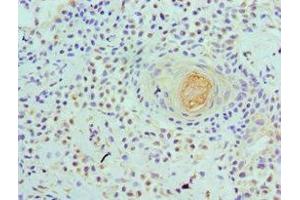 Immunohistochemistry of paraffin-embedded human breast tissue using ABIN7175761 at dilution of 1:100 (WDR5 anticorps  (AA 1-334))