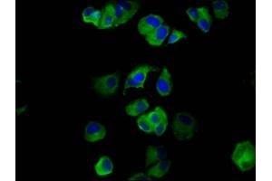 Immunofluorescence staining of MCF-7 cells with ABIN7160831 at 1:133, counter-stained with DAPI. (NLRP6 anticorps  (AA 154-306))