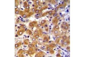 ABCB10 antibody immunohistochemistry analysis in formalin fixed and paraffin embedded human liver tissue.