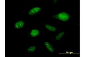 Immunofluorescence of purified MaxPab antibody to DDX50 on HeLa cell. (DDX50 anticorps  (AA 1-737))