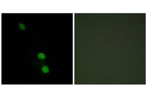 Immunofluorescence analysis of HepG2 cells, using TEAD2 antibody. (TEAD2 anticorps  (Internal Region))