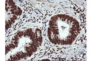 Image no. 7 for anti-THUMP Domain Containing 1 (THUMPD1) antibody (ABIN1501384) (THUMPD1 anticorps)